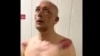 В Пензе завели дело на полицейских: они избили задержанного, раздели его догола и угрожали изнасилованием дубинкой
